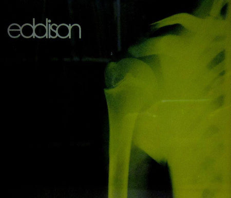 Eddison-