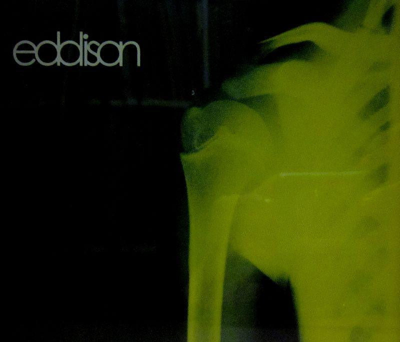 Eddison-